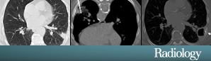 Second Radiology Highlight for This Month 