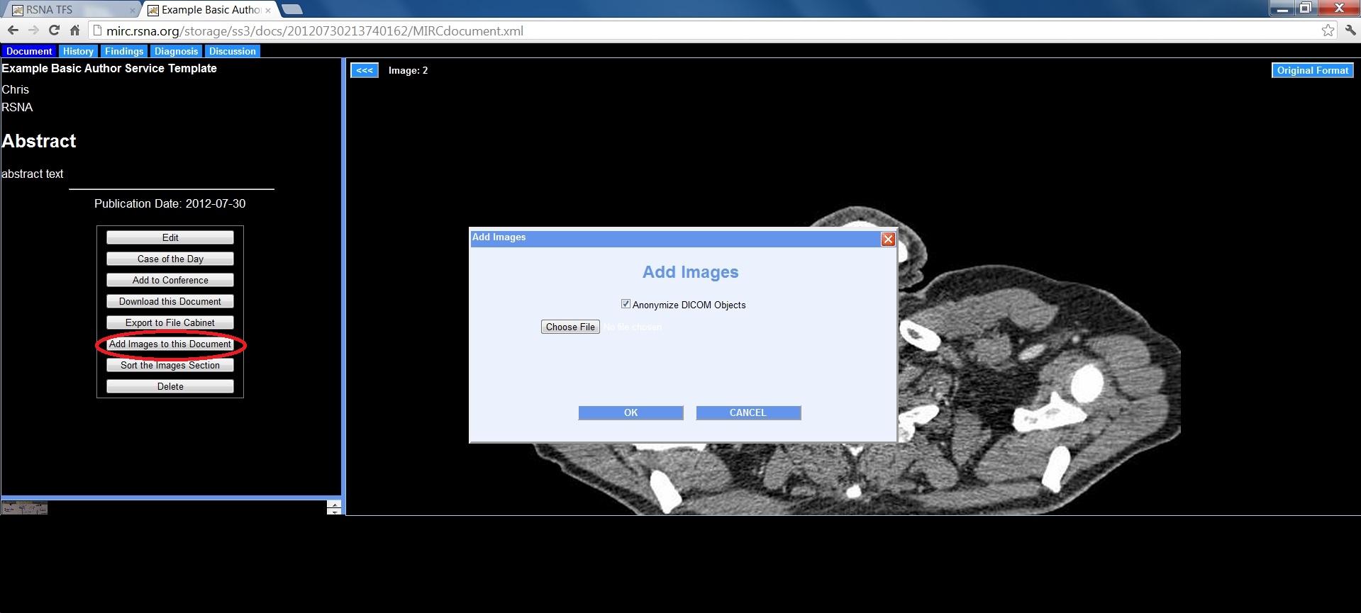 TFS add images
