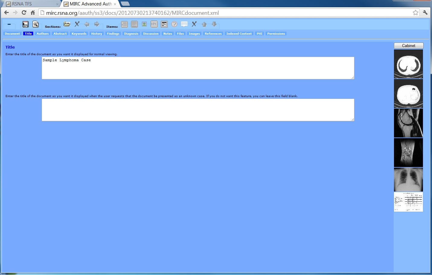 TFS Advanced authoring tool