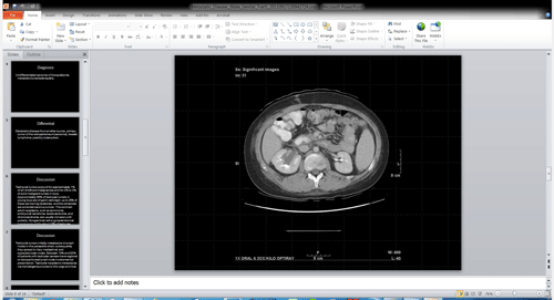 MIRC slide presentation - thumbnail - TFS export