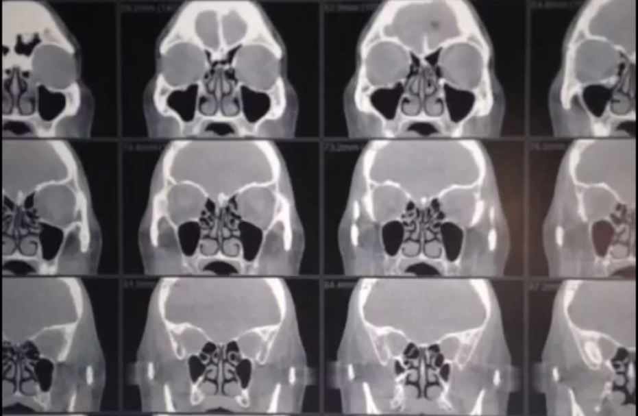 Imaging Forward video thumb Imaging Forward video thumb