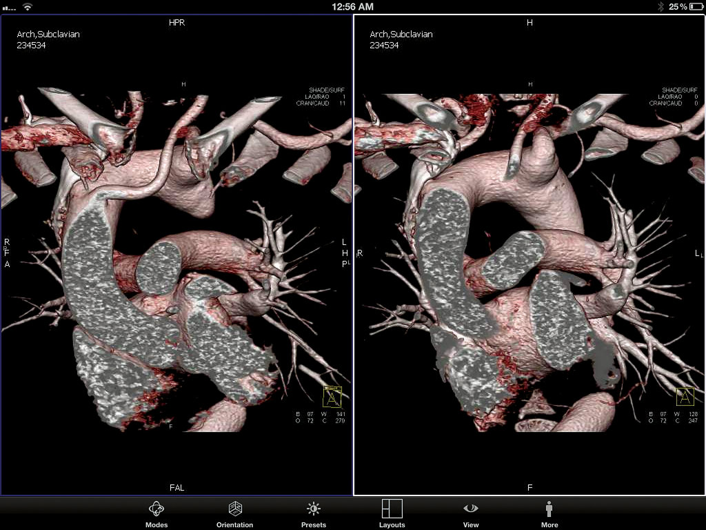 3D volume rendered images