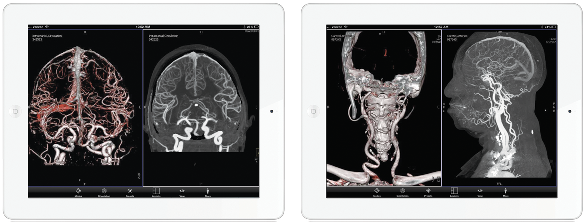Radiologic images on the iPad