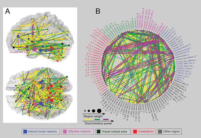 Whole-brain resting-state fMRI