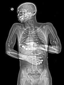 Lodox® Statscan Critical Imaging System