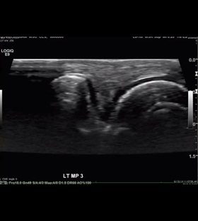 ultrasound-imaging-cv