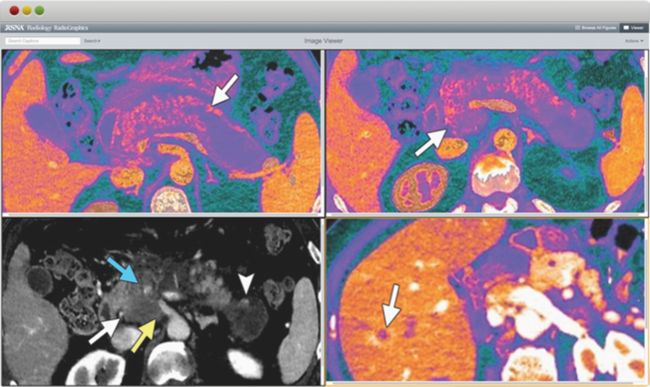  “The new Image Viewer provides functionality in new ways that parallel a diagnostic setting.” —Jeffrey S. Klein, M.D. Jeffrey S. Klein, M.D. 2014