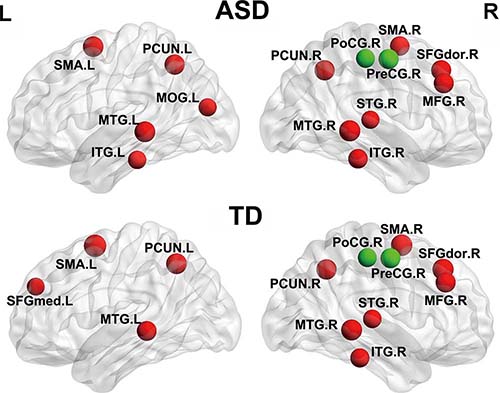 The distribution of hub regions in typical development (TD) and autism spectrum disorder (ASD) groups