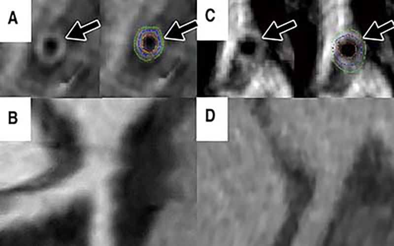 Gharem Figure 3