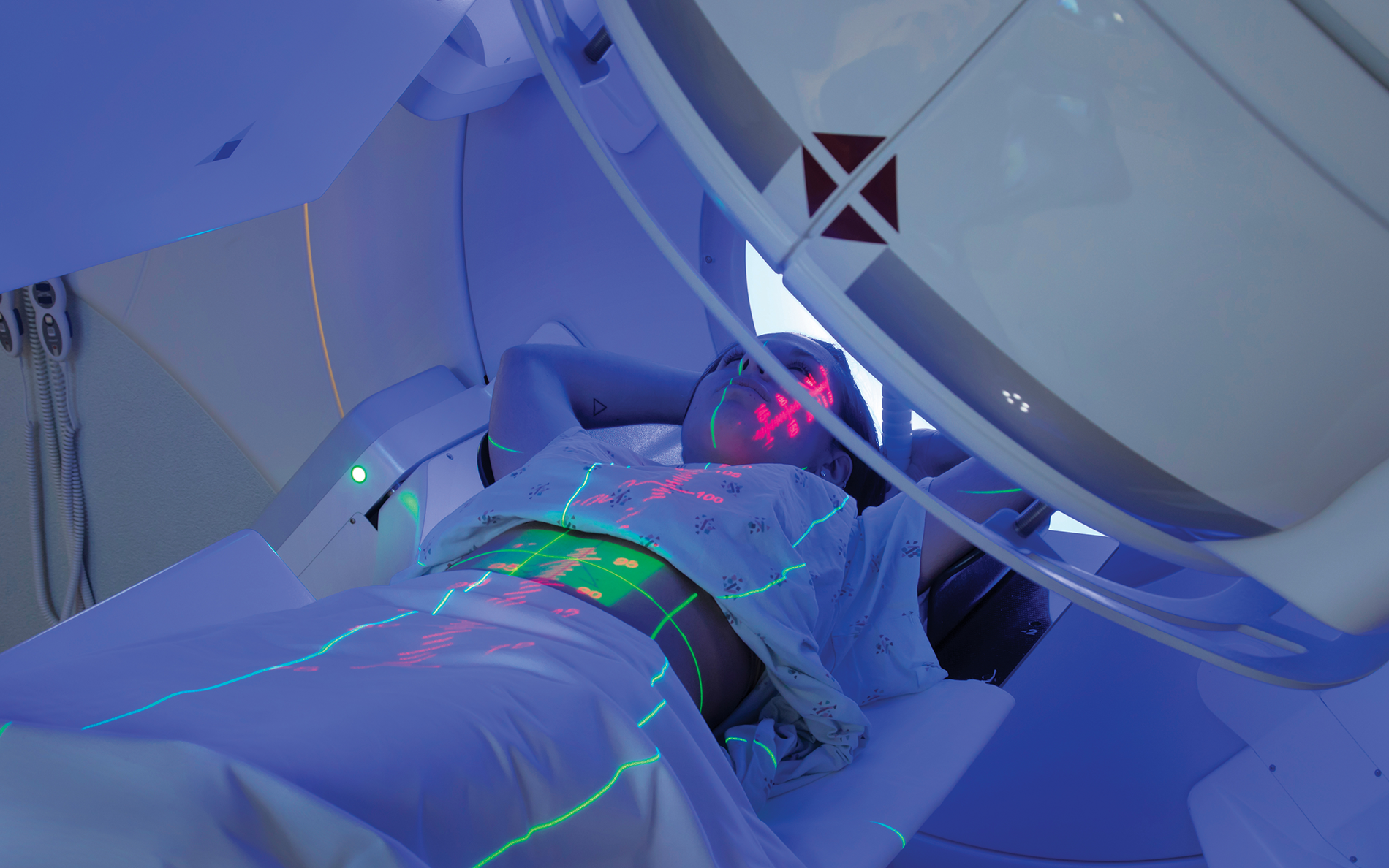 Stereotactic Body Radiation Therapy A New Paradigm for Radiation
