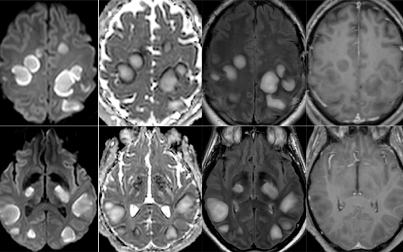 Contextual Structured Reporting In Radiology Implementation And Long Term Evaluation In Improving The Communication Of Critical Findings Springerlink