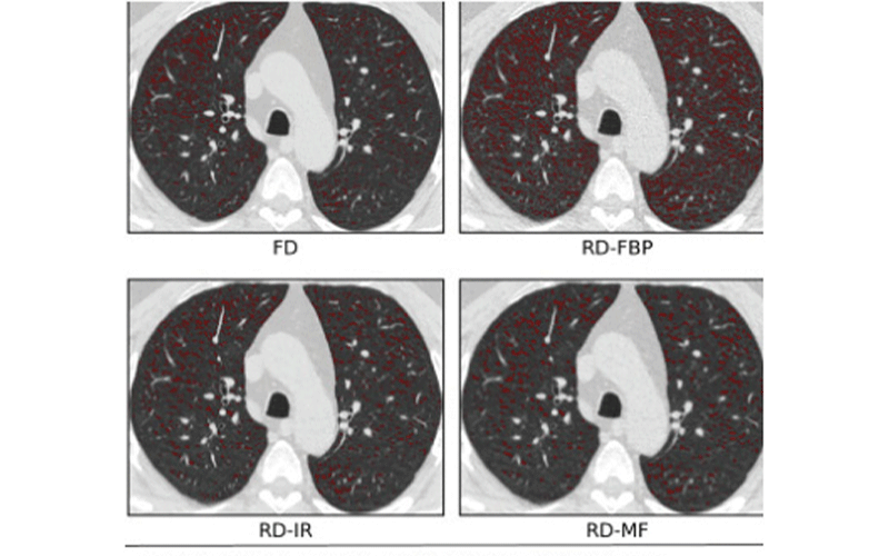 low dose CT research image 2