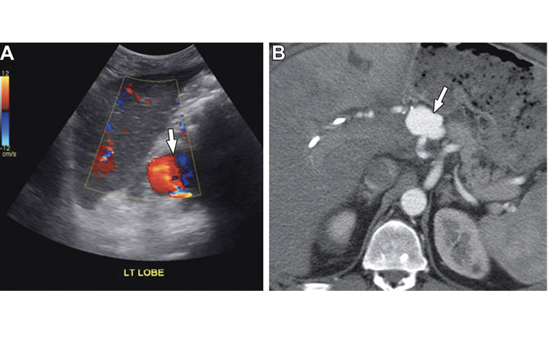Brookmeyer feature figure 1
