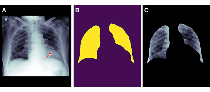 Рис. 4 Эриксон