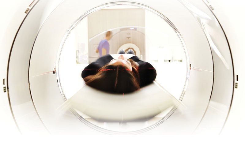 MRI feature