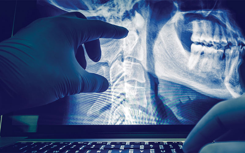 spine and jaw X-ray feature