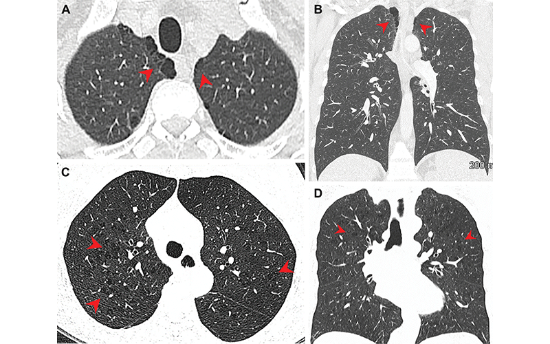 Fig 3 Murtha Revah