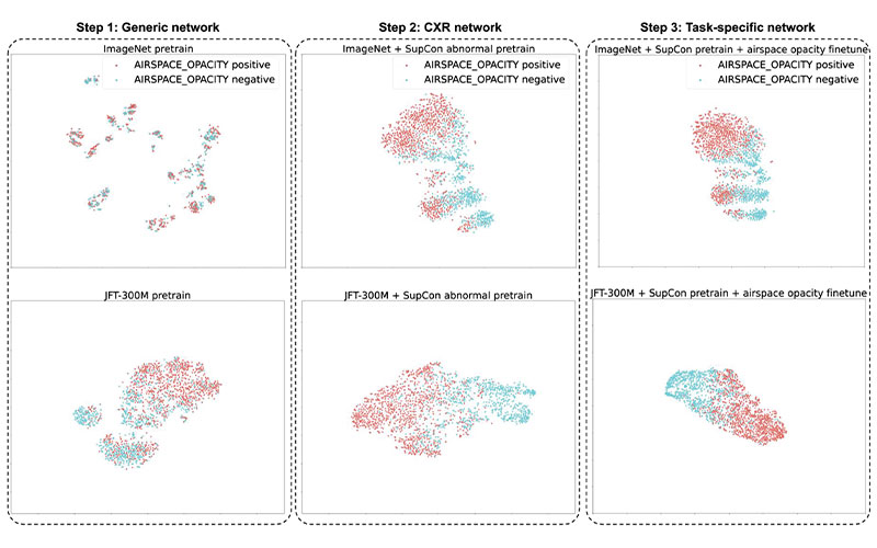 AI Chest X-Ray Classification | RSNA