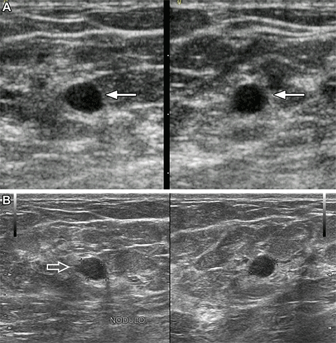 Berg Radiology breast lumps ultrasound
