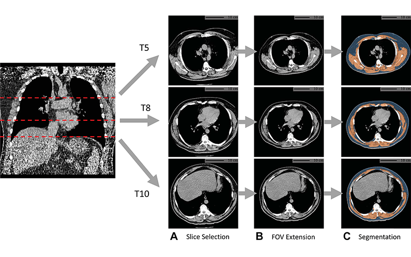Xu Radiology Fig 1 Chest CT
