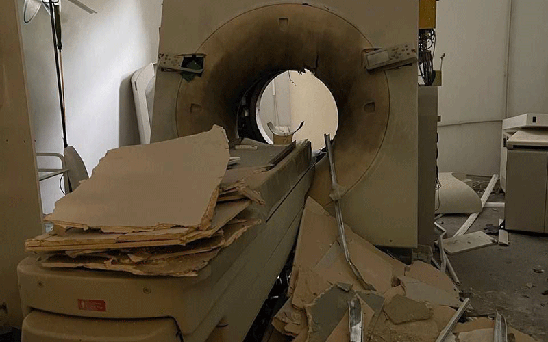 Chukanov CT损伤特性