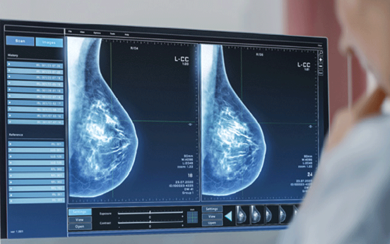 Breast imaging computer