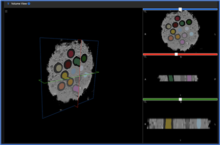 Figure 2 qCal-MRTM allows real time slice-by-slice visualization of automated analysis products.