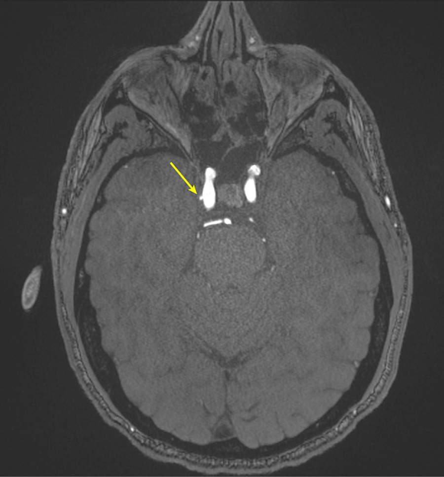 Press release image 3