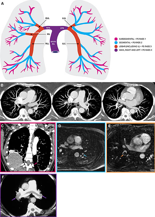 fig-2