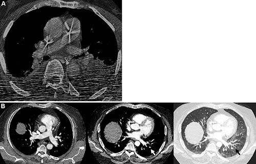 fig-3