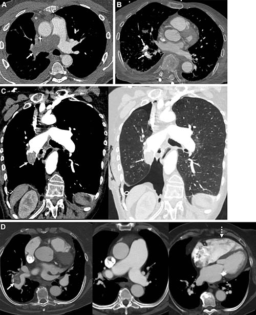 fig-4
