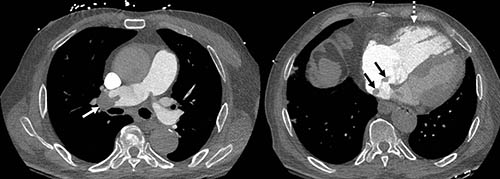 fig-6