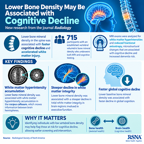 Infographic