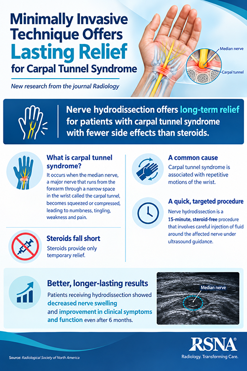Carpal Tunnel Syndrome Infographic