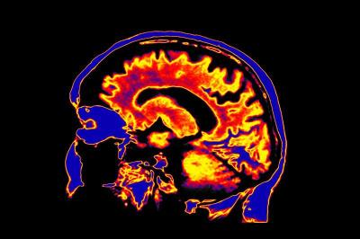 Molecular Imaging
