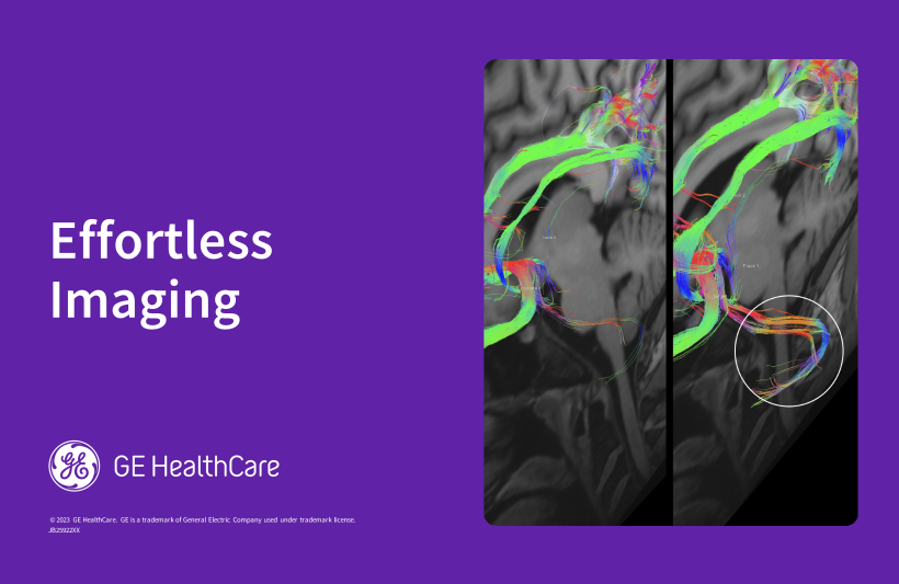 Meet imaging challenges with AI and deep-learning solutions