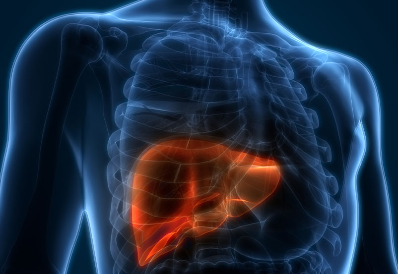 Nonspecific Liver Lesions