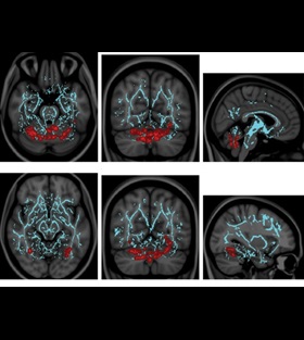 magnetic-resonance-imaging-cv