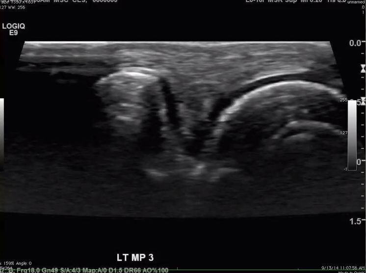 ultrasound-imaging-cv