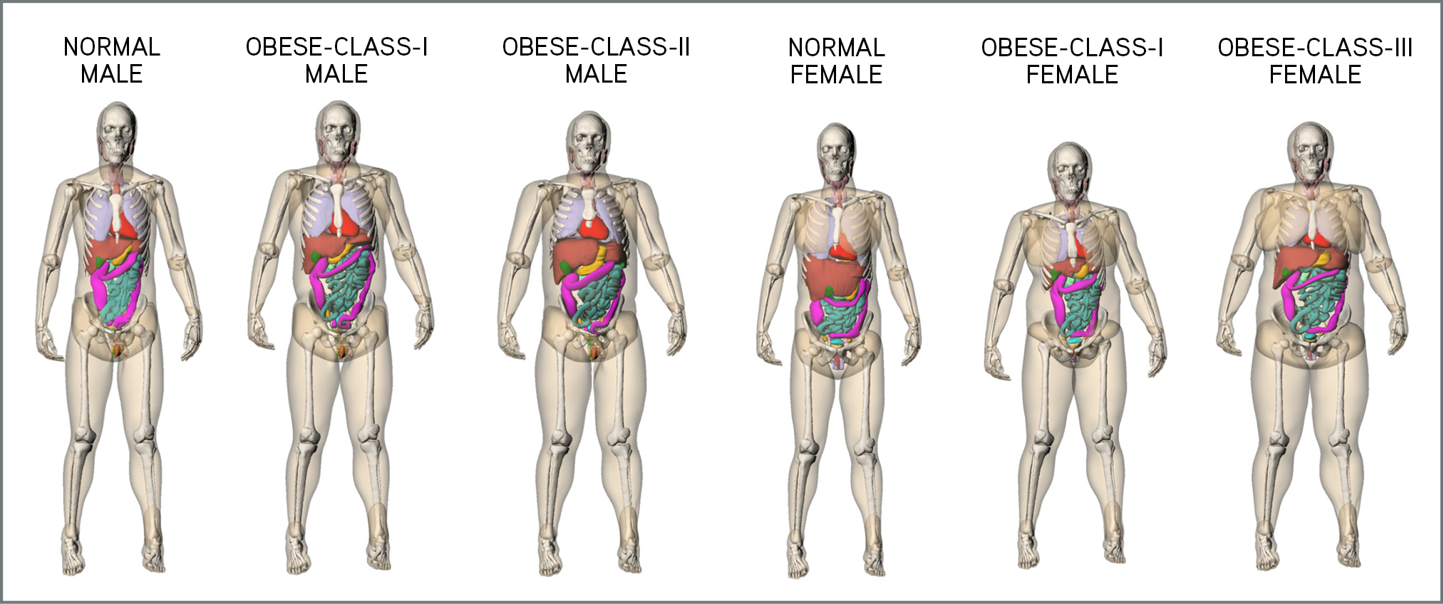 With the aid of an RSNA Presidents Circle Research Resident Grant, Xiang Li, Ph.D., set out to create a dose-reporting system that provides estimates of radiation dose and potential cancer risk index specific to each patient and each CT exam. Above: An image from Dr. Li’s research included six computational phantoms representing patients of different body mass index categories. Li X, et. al., Effects of Protocol and Obesity on Dose Conversion Factors in Adult Body CT. Med Phys. 39(11):6550-71 (2012) With the aid of an RSNA Presidents Circle Research Resident Grant, Xiang Li, Ph.D., set out to create a dose-reporting system that provides estimates of radiation dose and potential cancer risk index specific to each patient and each CT exam. Above: An image from Dr. Li’s research included six computational phantoms representing patients of different body mass index categories. Li X, et. al., Effects of Protocol and Obesity on Dose Conversion Factors in Adult Body CT. Med Phys. 39(11):6550-71 (2012)