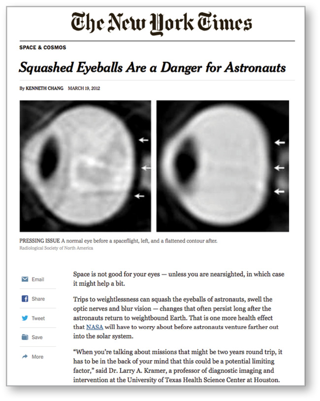 PIC members help develop press releases stemming from Radiology research that are distributed to media outlets across the globe for news coverage. PIC members help develop press releases stemming from Radiology research that are distributed to media outlets across the globe for news coverage.