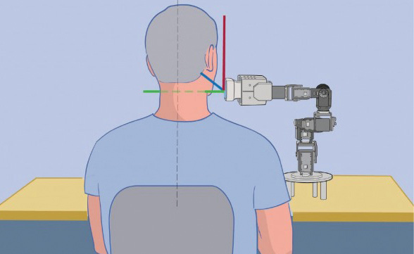 A simplified schematic of the telerobotic ultrasound technology's 3-D movement capabilities. Image courtesy of Sarah Doherty A simplified schematic of the telerobotic ultrasound technology's 3-D movement capabilities. Image courtesy of Sarah Doherty