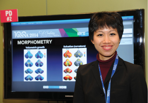 Dr. Ho with her RSNA 2014 research. Dr. Ho with her RSNA 2014 research.