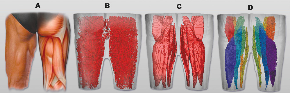 The posterior view of segmented muscles and fiber tractography. The posterior view of segmented muscles and fiber tractography.