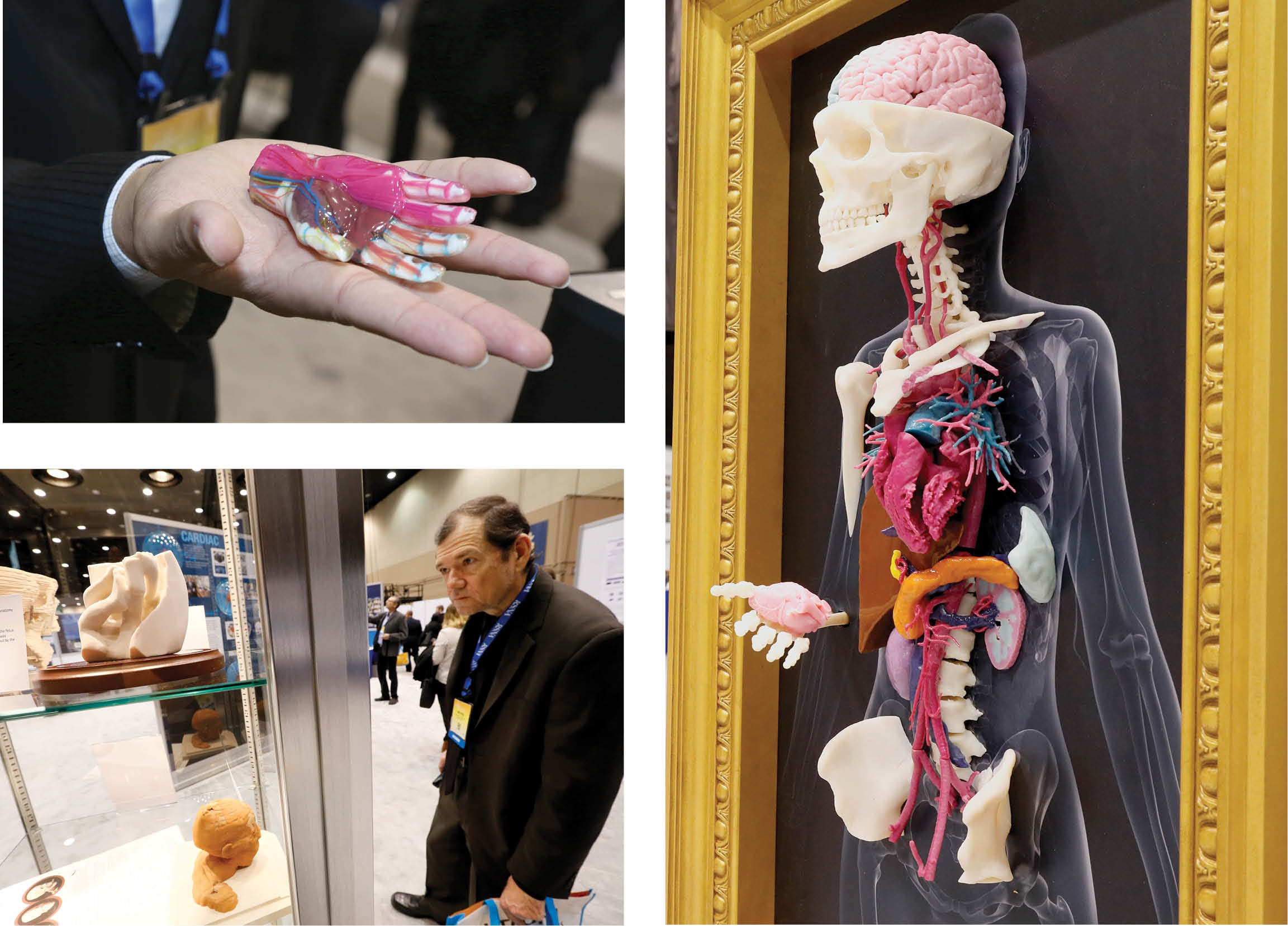 The 3-D Printing in Medicine exhibit at RSNA 2016 The 3-D Printing in Medicine exhibit at RSNA 2016