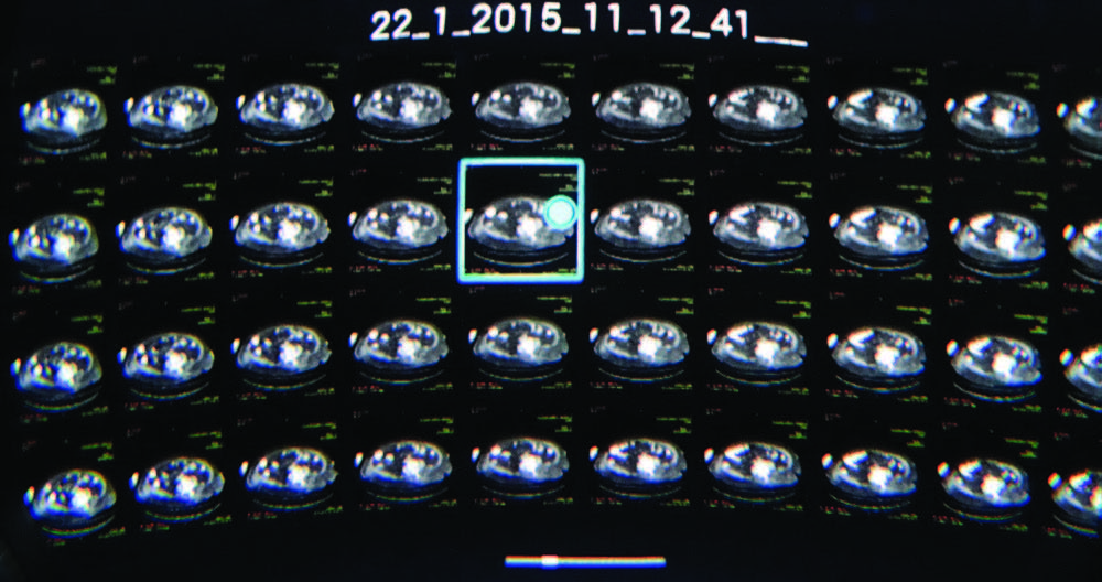 A screenshot displays a CT examination in the virtual reality system. A screenshot displays a CT examination in the virtual reality system.