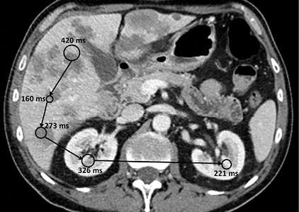 Fixations and saccades projected on a CT image Fixations and saccades projected on a CT image