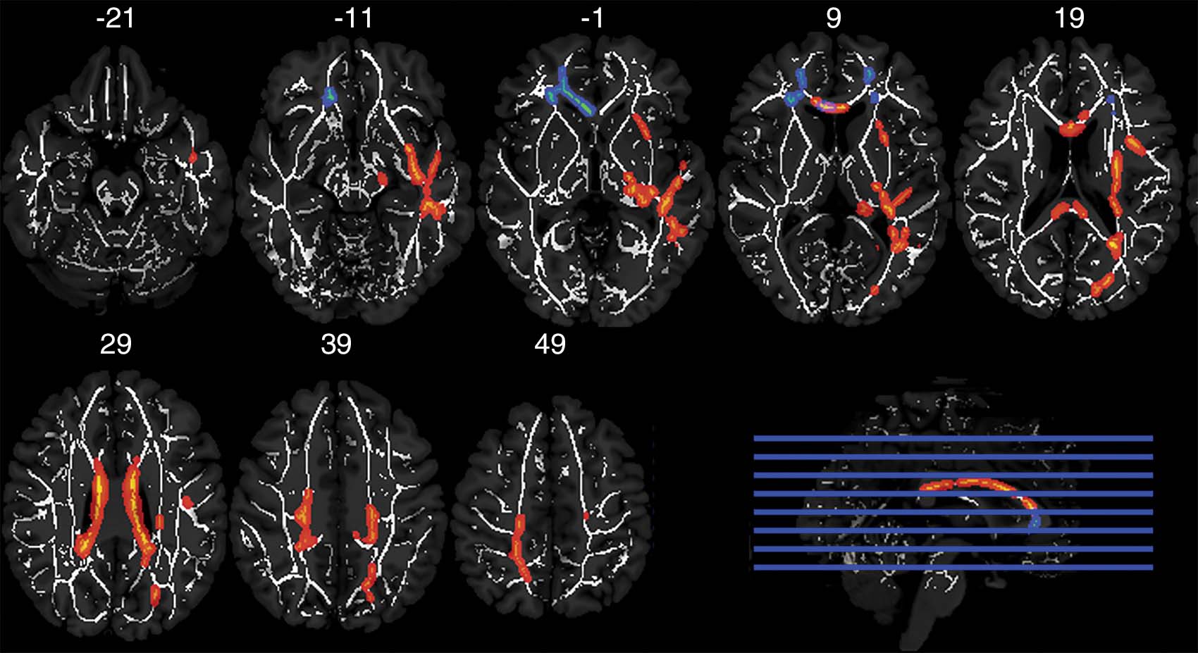 Axial MRIs Axial MRIs