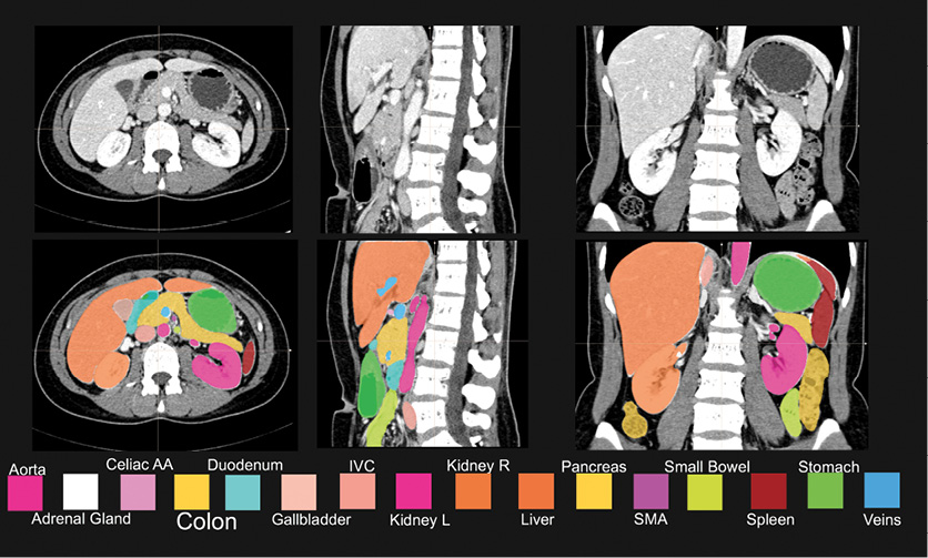 multi-organ segmentation result of the abdomen