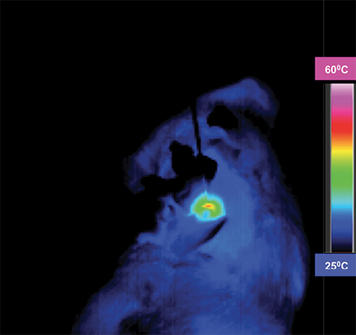 R2 and R2* imaging and quantification R2 and R2* imaging and quantification